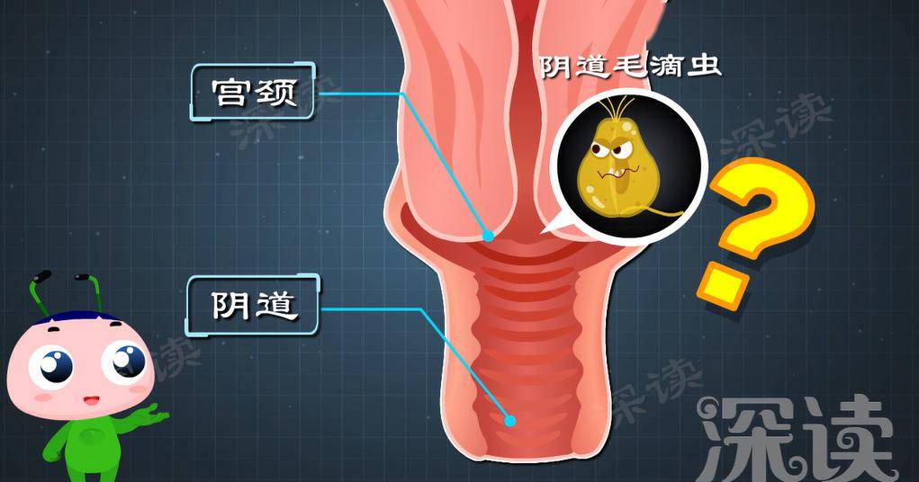 滴虫外阴炎图片症状图片