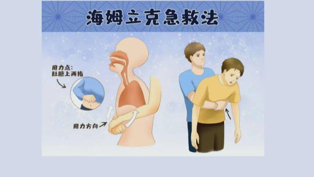 异物_急救法_孩子
