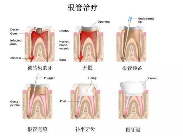 当后牙出现黑线牙齿已亮起红灯
