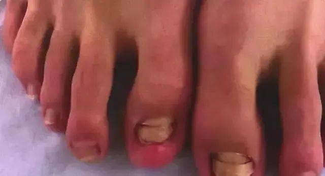 恐怖的温泉鱼疗吃脚皮治脚气全是假象一条大鱼放进去只剩骨架