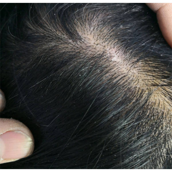 去屑控油好的洗发水