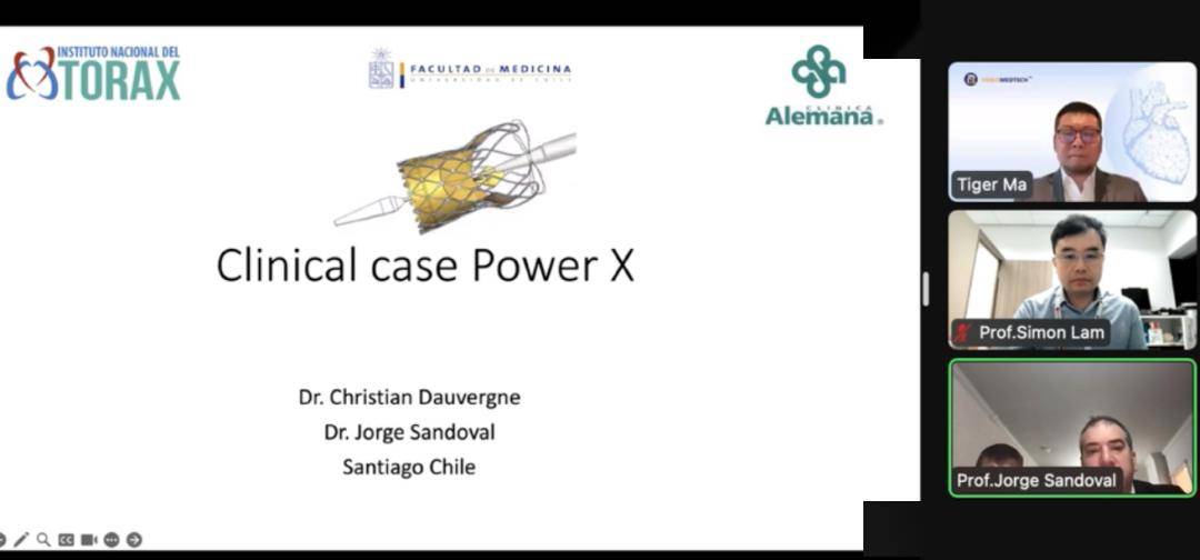 启明医疗全释放全回收干瓣venuspowerx最新研究数据公布0全因死亡0