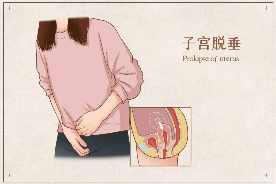 人都吓昏了…_子宫_女性_严重