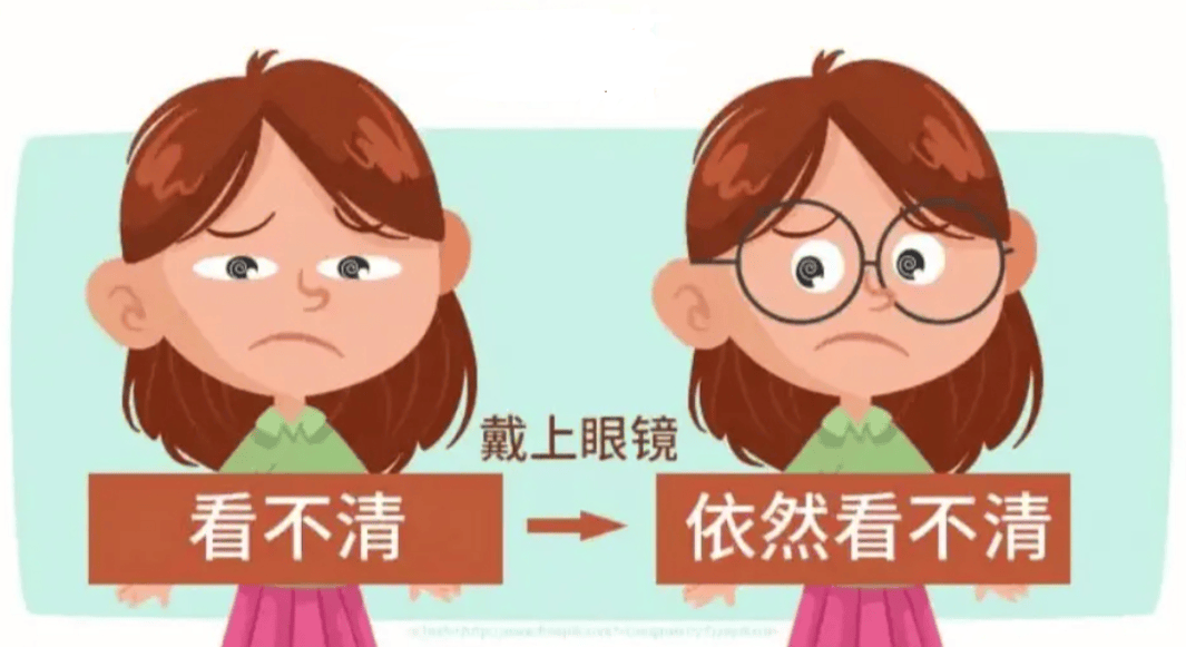 关于弱视,家长必须储备这些知识