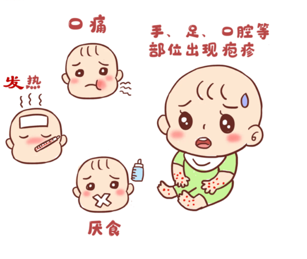 注意手足口病高发季来临这份预防指南转给师生家长