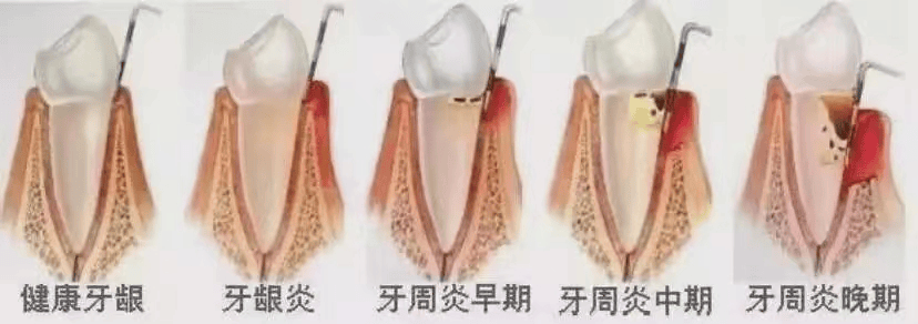 27岁的小张牙都快掉了快来看看咋回事