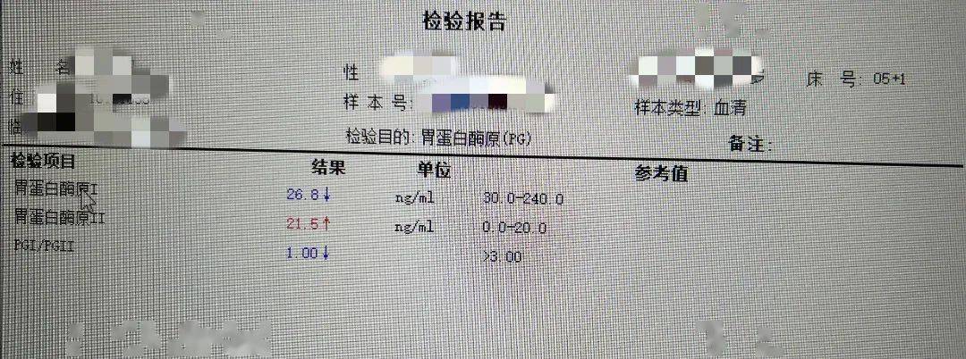 患者碳呼气试验结果显示为阳性,提示胃部存在幽门螺杆菌(hp)感染,而