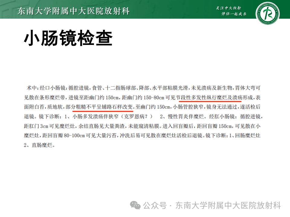 克罗恩病