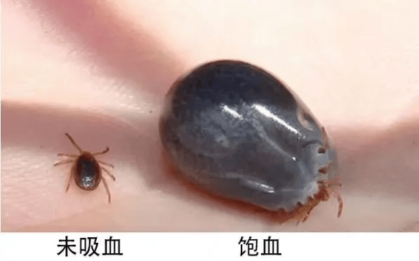 被蜱虫叮咬后蜱虫的唾液会引起周围血管炎局部充血,水肿,出血及角质层