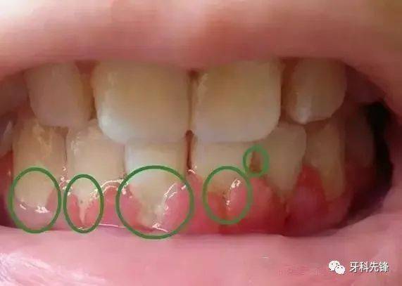 牙医给自然脱落的牙齿拍微距照片万万没想到