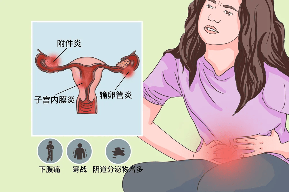 妇科炎症各种症状图片图片