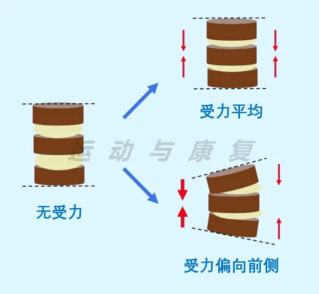 腰椎受力图解图片