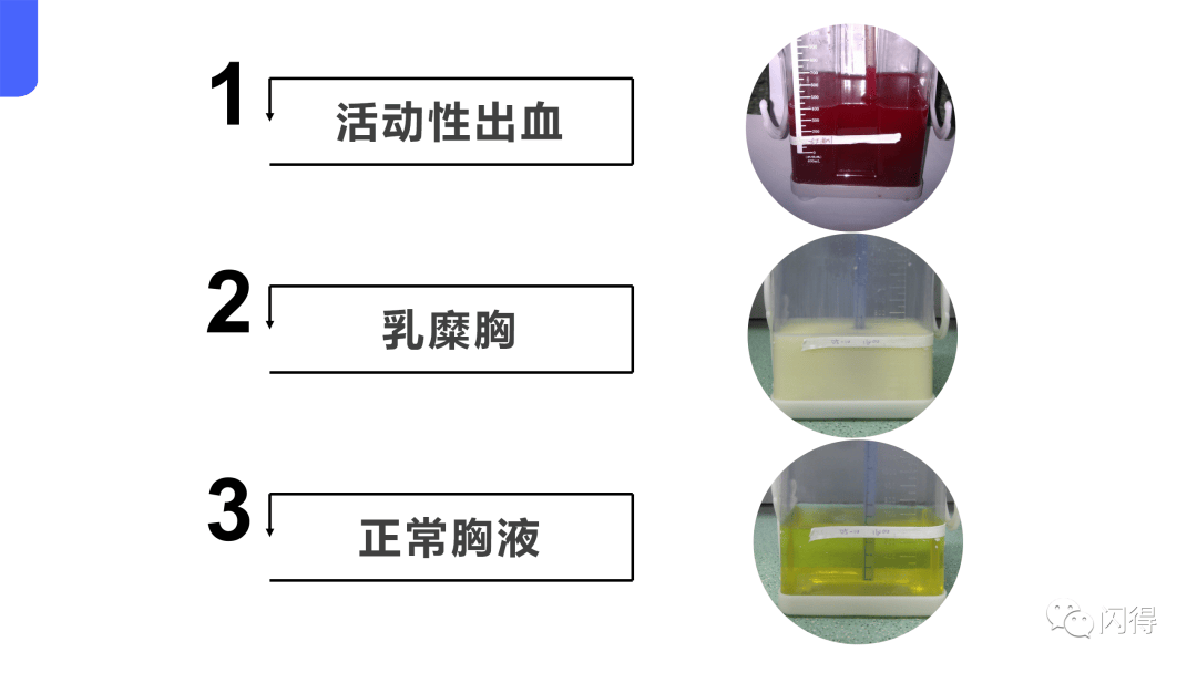 引流液颜色参考图片图片