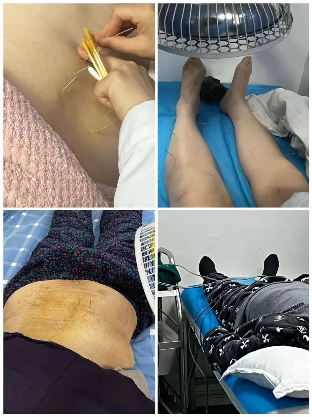 康复医学科一个被严重小瞧的科室