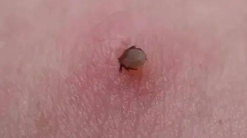 小小蜱虫危害大这些事项要关注