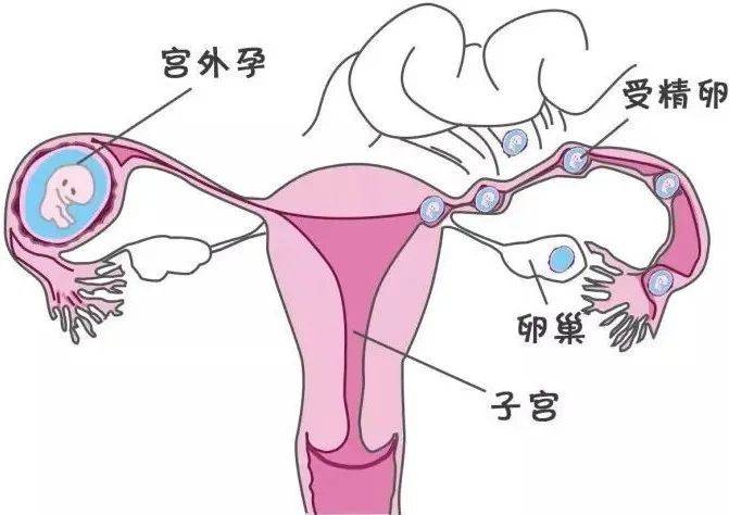 2%的姑娘有过同房痛?别侥幸,可能问题出在这…