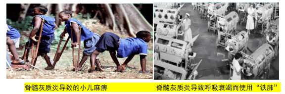 脊灰病毒是一种肠道病毒,主要通过粪-口途径传播,分为Ⅰ型,Ⅱ型,Ⅲ型