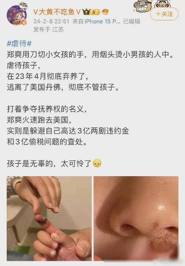 郑爽星光背后的阴影能否破茧重生