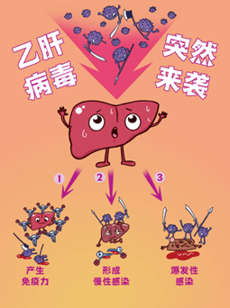 其实,乙肝病毒并不直接杀伤肝细胞,病毒感染所引起的细胞免疫应答是