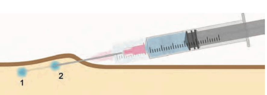 一例犬草酸钙结石的诊断与治疗报告——孙志勇