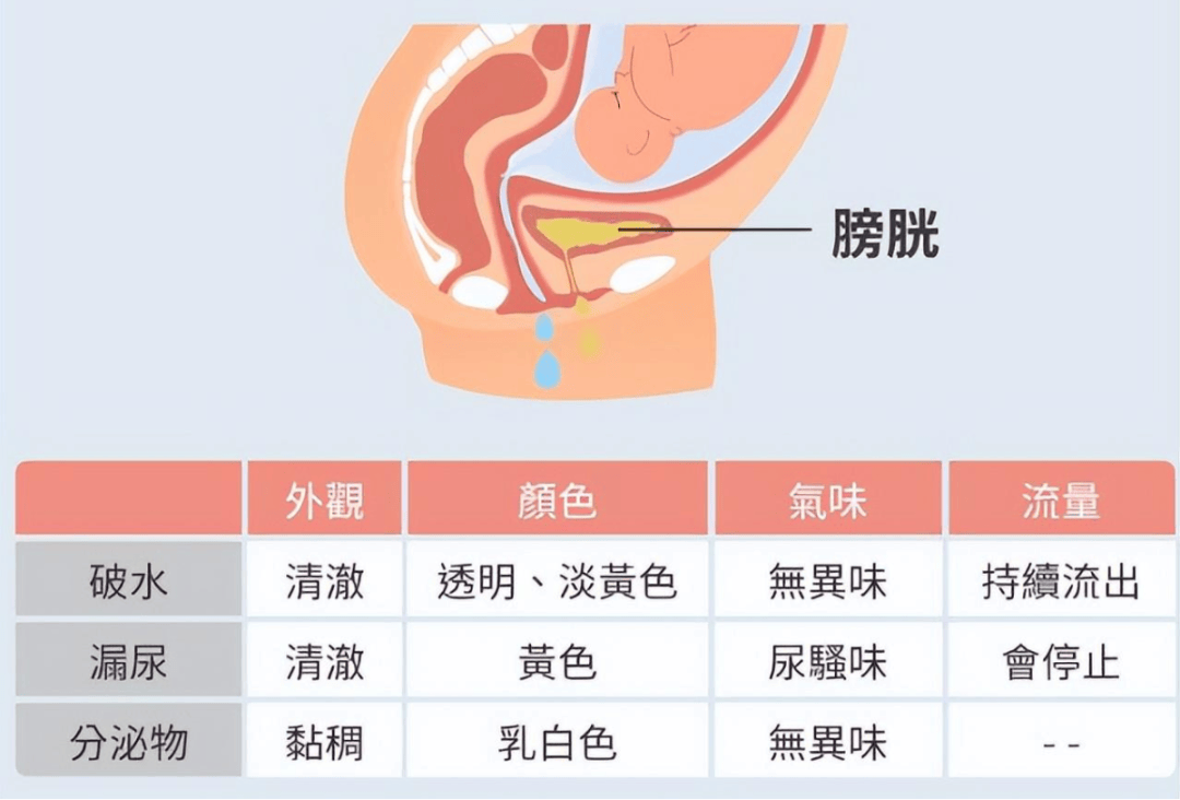 临产孕妈羊水早破咋办?别慌 听我速速道来~『东莞现代妇产医院』