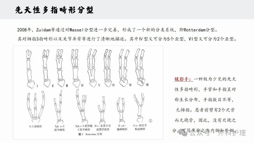 指蹼成形术图解图片