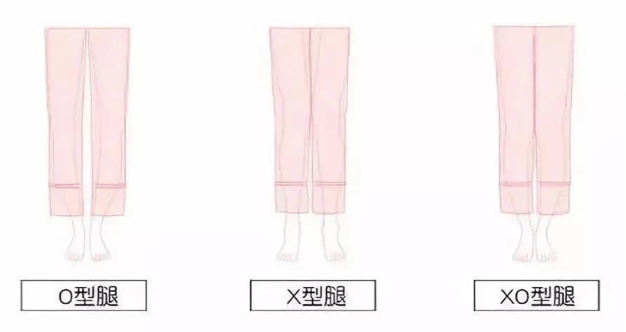 不管你是o型,x型,xo型,穿上通通都是筷子腿既视感.