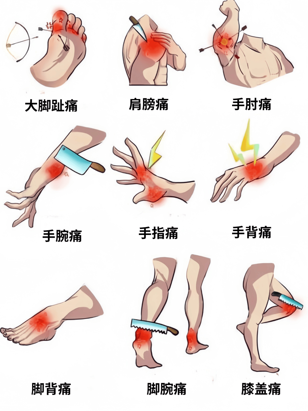 痛风部位图片 位置图图片