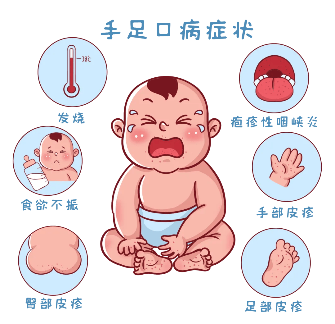 【眉县疾控提醒您】手足口进入高发期,如果得了手足口病,家长应该怎么