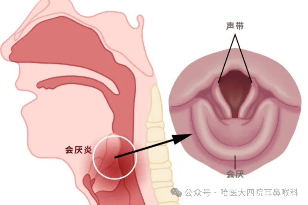 会厌在什么位置图片图片