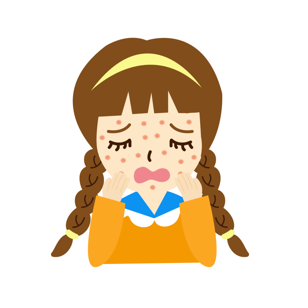 麻疹是由麻疹病毒引起的急性呼吸道传染病,每年的5月是麻疹的季节性