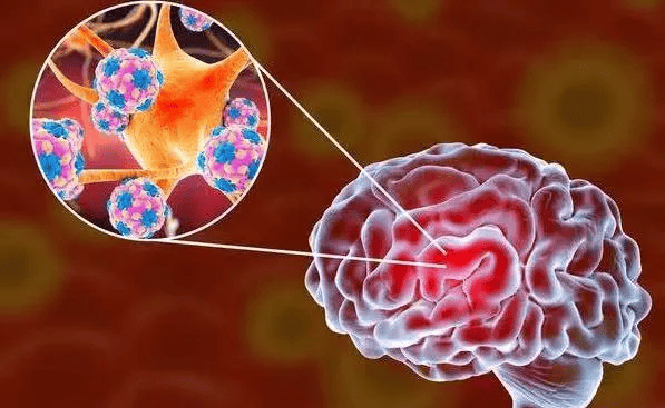 乙脑病毒主要侵犯人的中枢神经系统,病死率和后遗症率均较高.