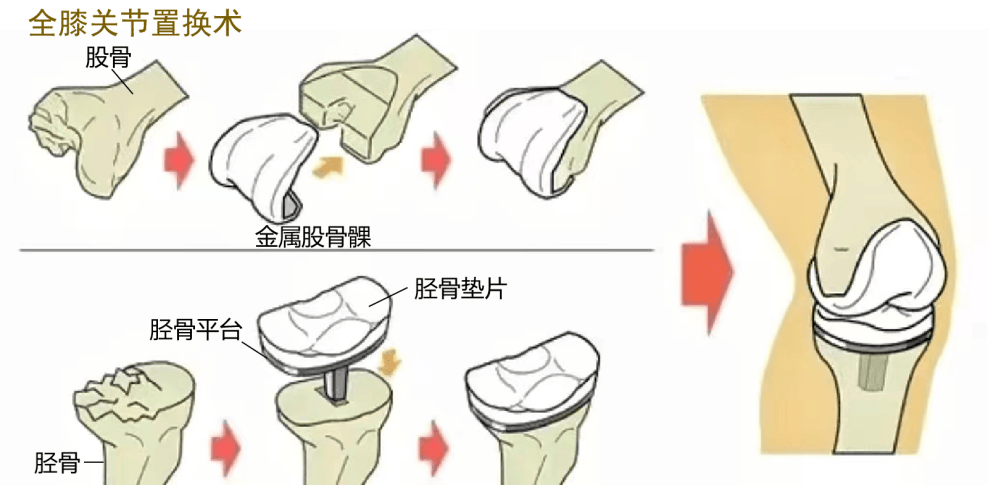 降!国家"团购"结果公布