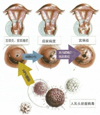 产后脓性分泌物图片图片