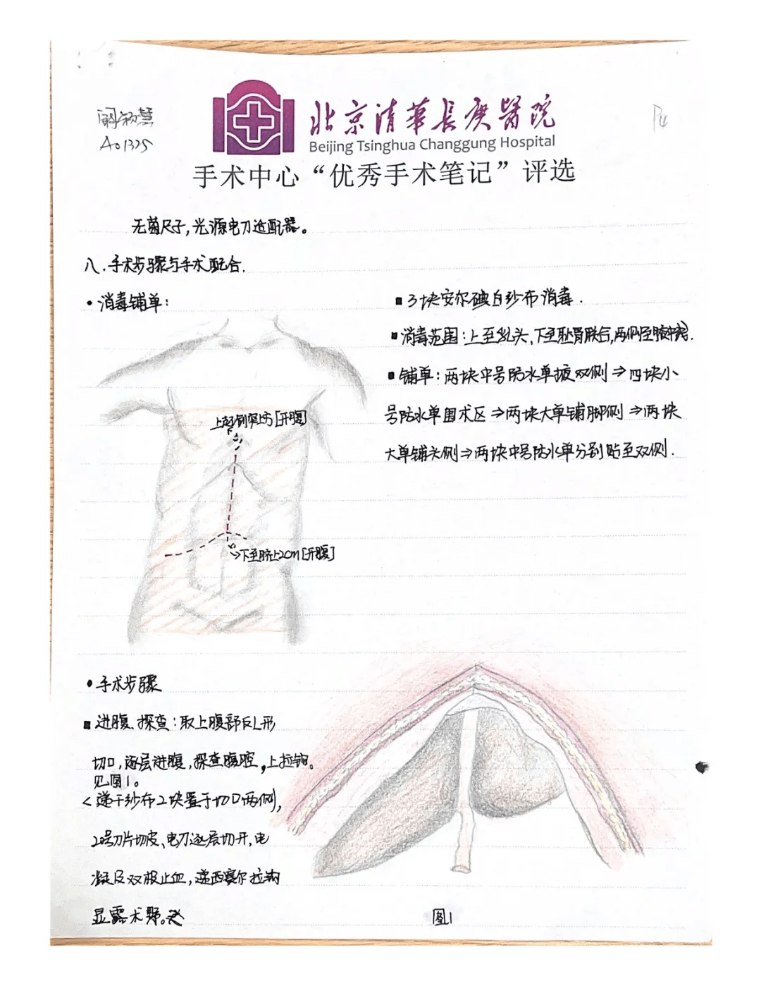 分享一份让护理部都为之颤抖的手术护理笔记