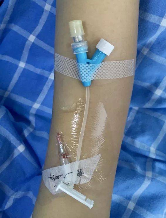 提问:留置针这样固定有问题?带教老师发话了