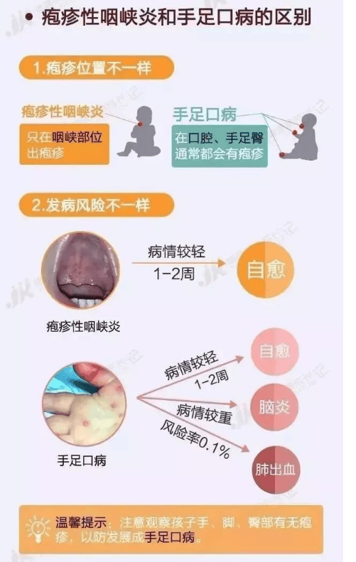 科普在线 宝宝突然发高烧