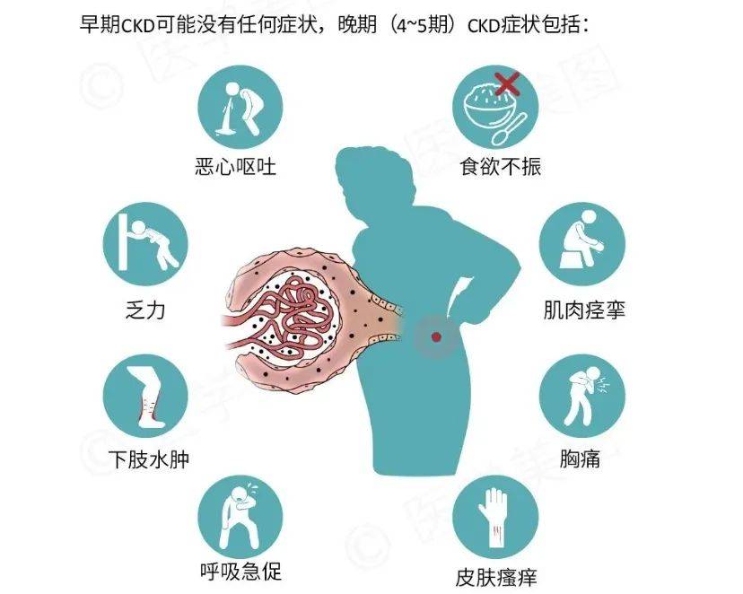 慢性肾脏病(ckd)是一种悄然发生的疾病,其隐蔽性使得许多患者在病情