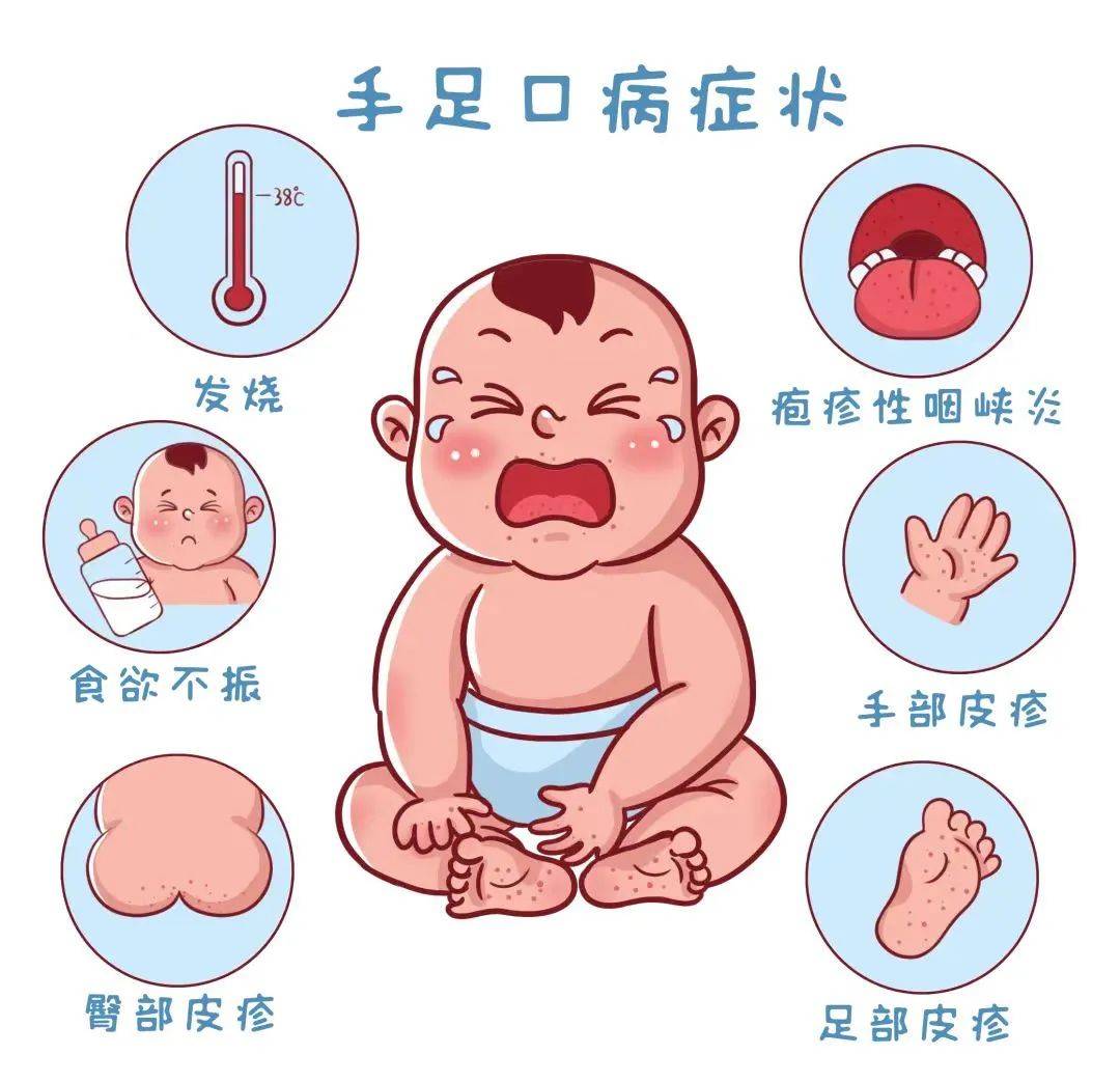 【友谊科普】手足口病高发季,做好这些防范起来!_患儿_症状_护理