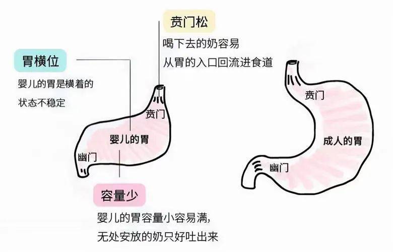 新生儿胃呈水平图片图片