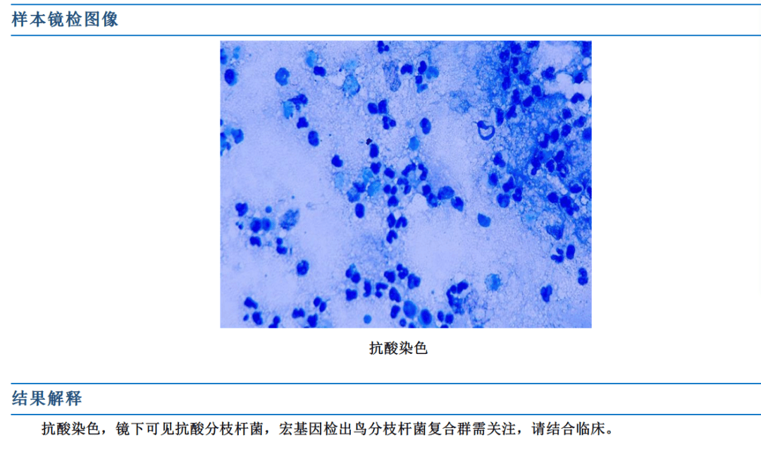 荚膜负染色图片