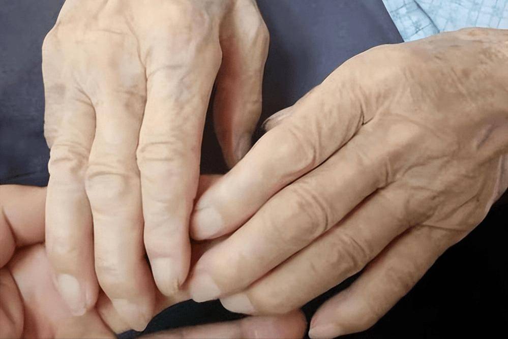 医生:若是手指有这些表现,尽快就诊