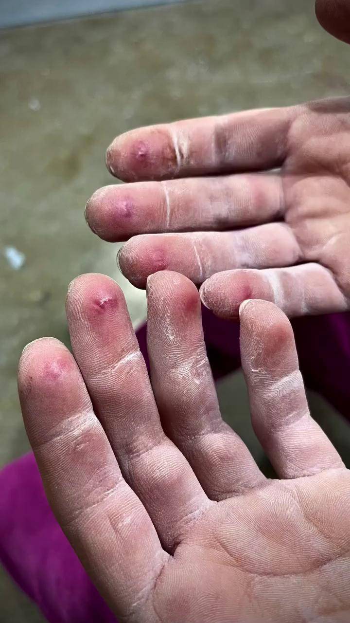 攀岩时间长了会磨破手皮,你知道该如何用胶带缠手吗?