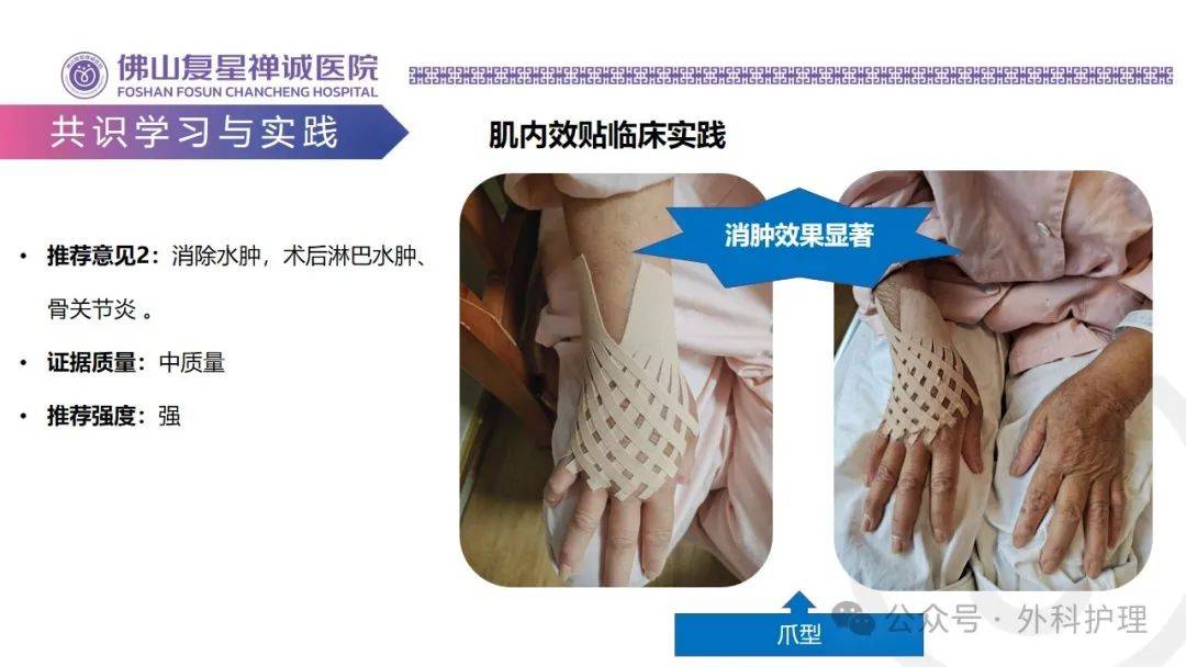 【ppt】《中国肌内效贴技术临床应用专家共识》学习分享