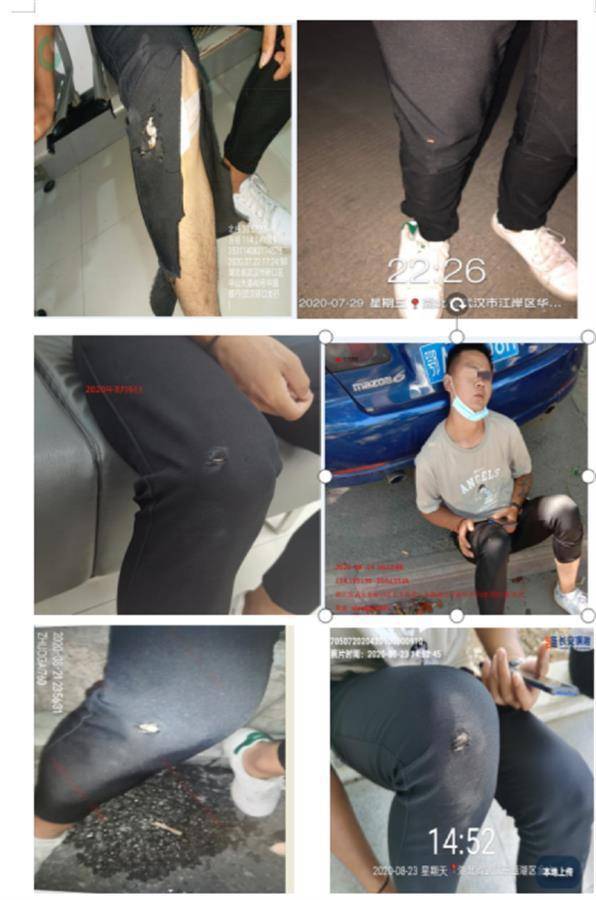 伤情报告存在"多次穿同一条破裤子"的情况一年内出"车祸"32次"警保