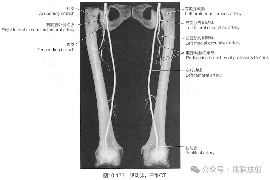 下肢动脉断层解剖图图片