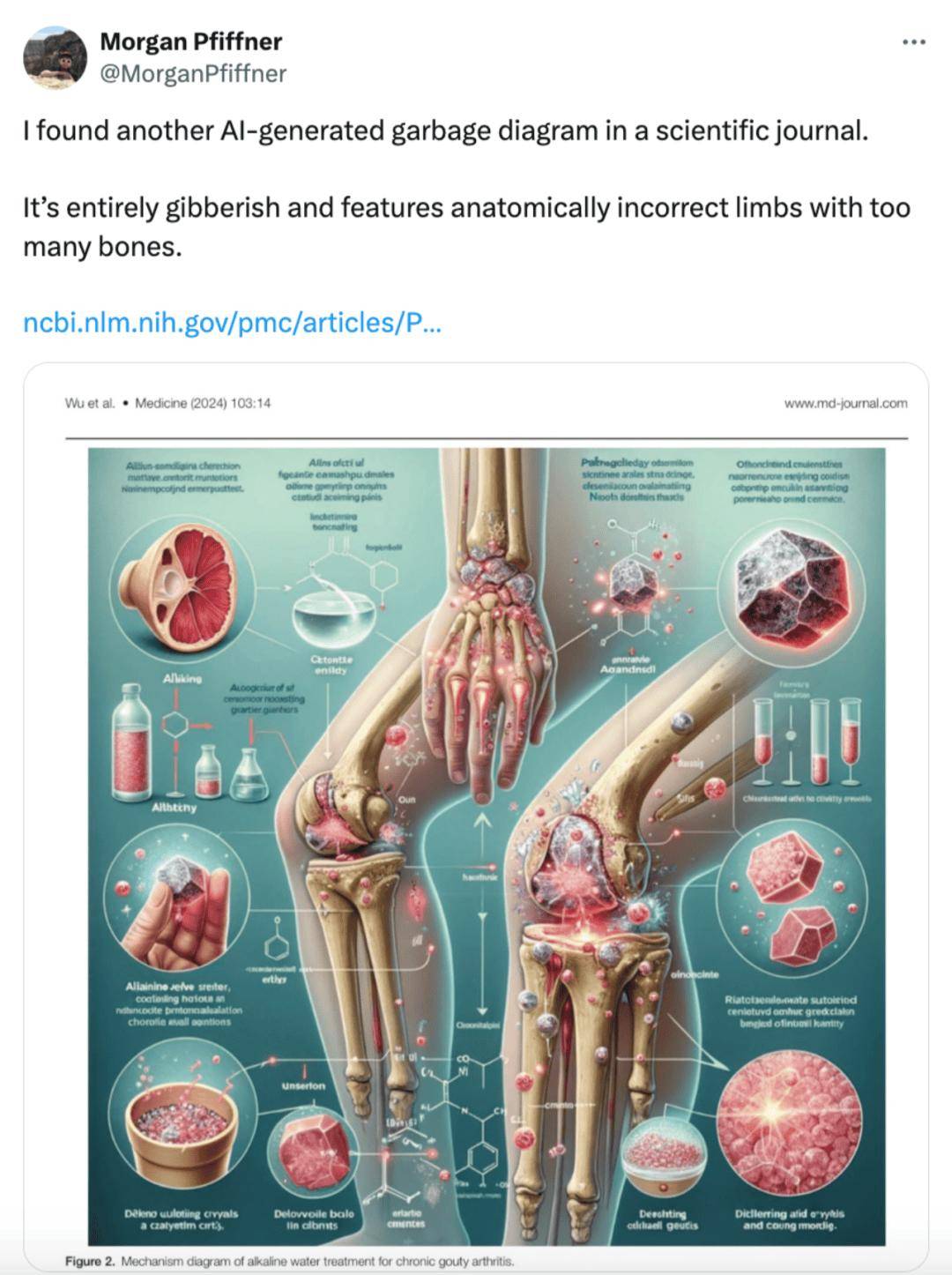 发表 SCI 被炮轰撤稿！广州医生用 AI 画出离谱插图，辩称经费有限、没钱润色