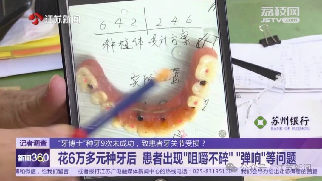 七旬老伯为种牙拔了10颗好牙 没想到花了6万多后竟然损伤(图3)