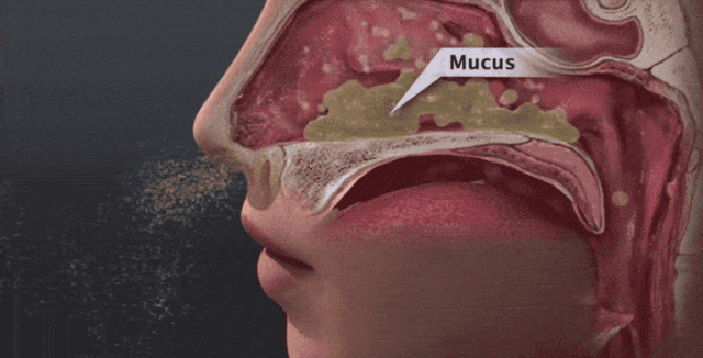 鼻涕存在鼻子部位图片图片