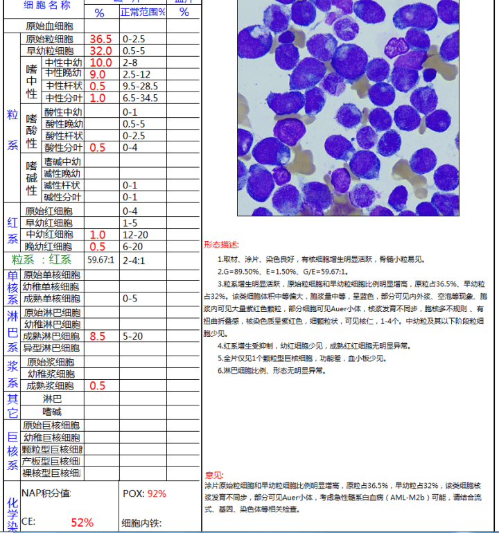 骨髓形态报告dce染色mpo染色骨髓细胞形态外周血细胞形态实验室检查30